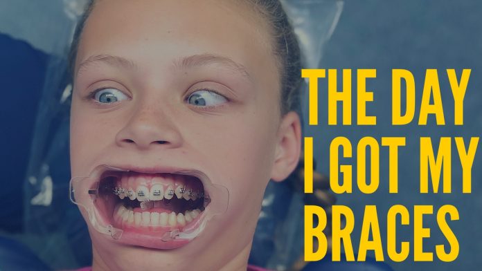 Getting Braces