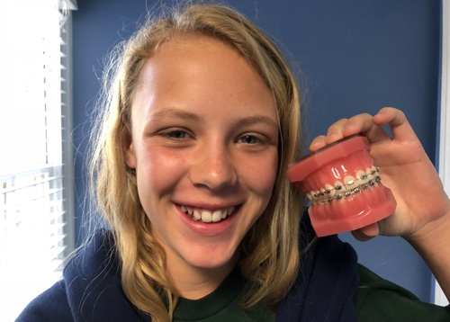 Teen Braces